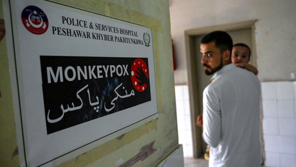 Pakistan intensifies measures to contain Mpox amid local spread